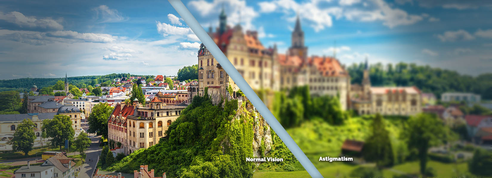Astigmatism Treatment in Pearland