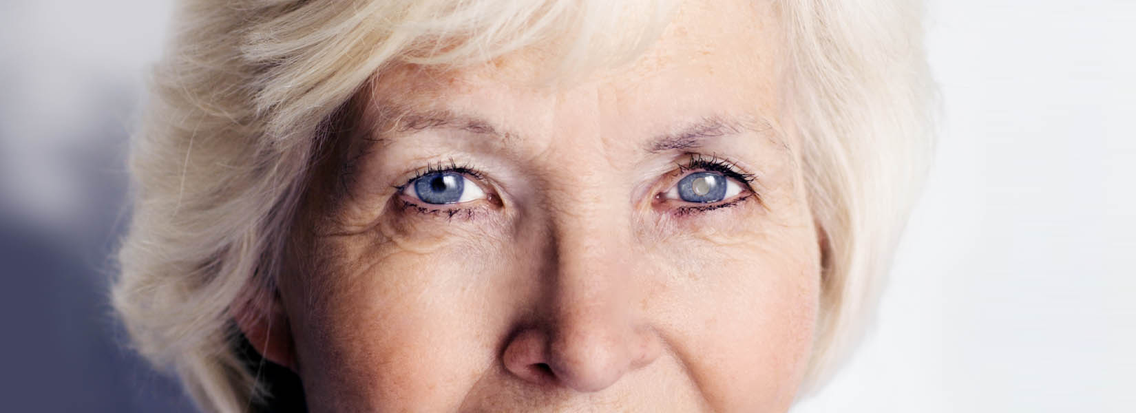 Cataract Surgery in Pearland